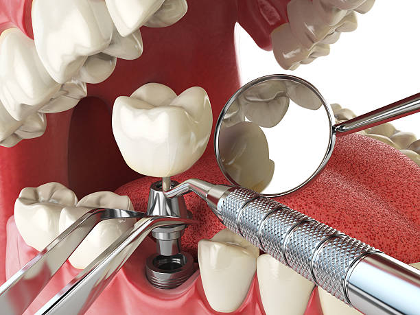 Best Pediatric Emergency Dentist in Clermont, IN